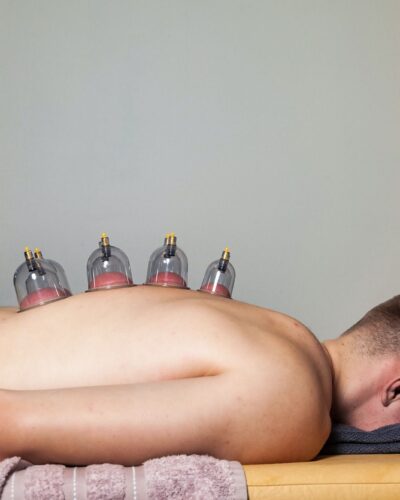 Multiple vacuum cups on human back, medical cupping therapy in room